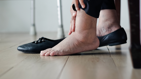Oteklé nohy – jaké jsou příčiny? Tipy jak se otoku zbavit