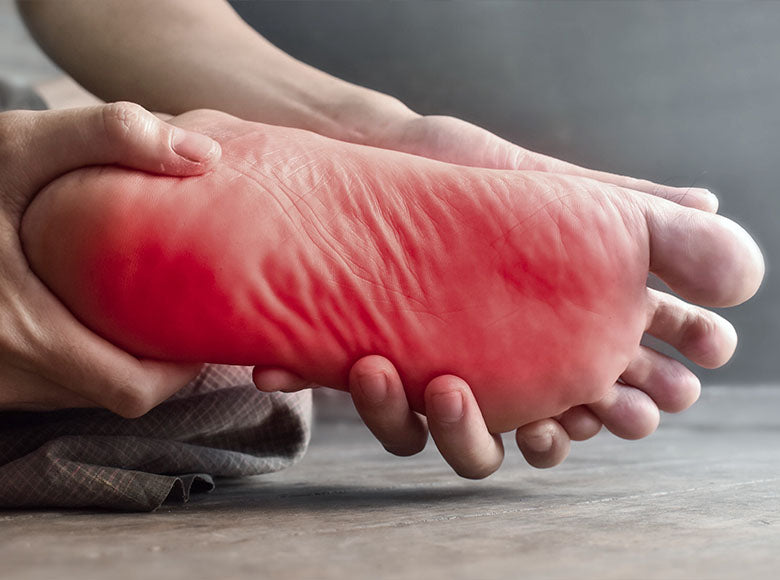 Neuropatická bolest chodidla